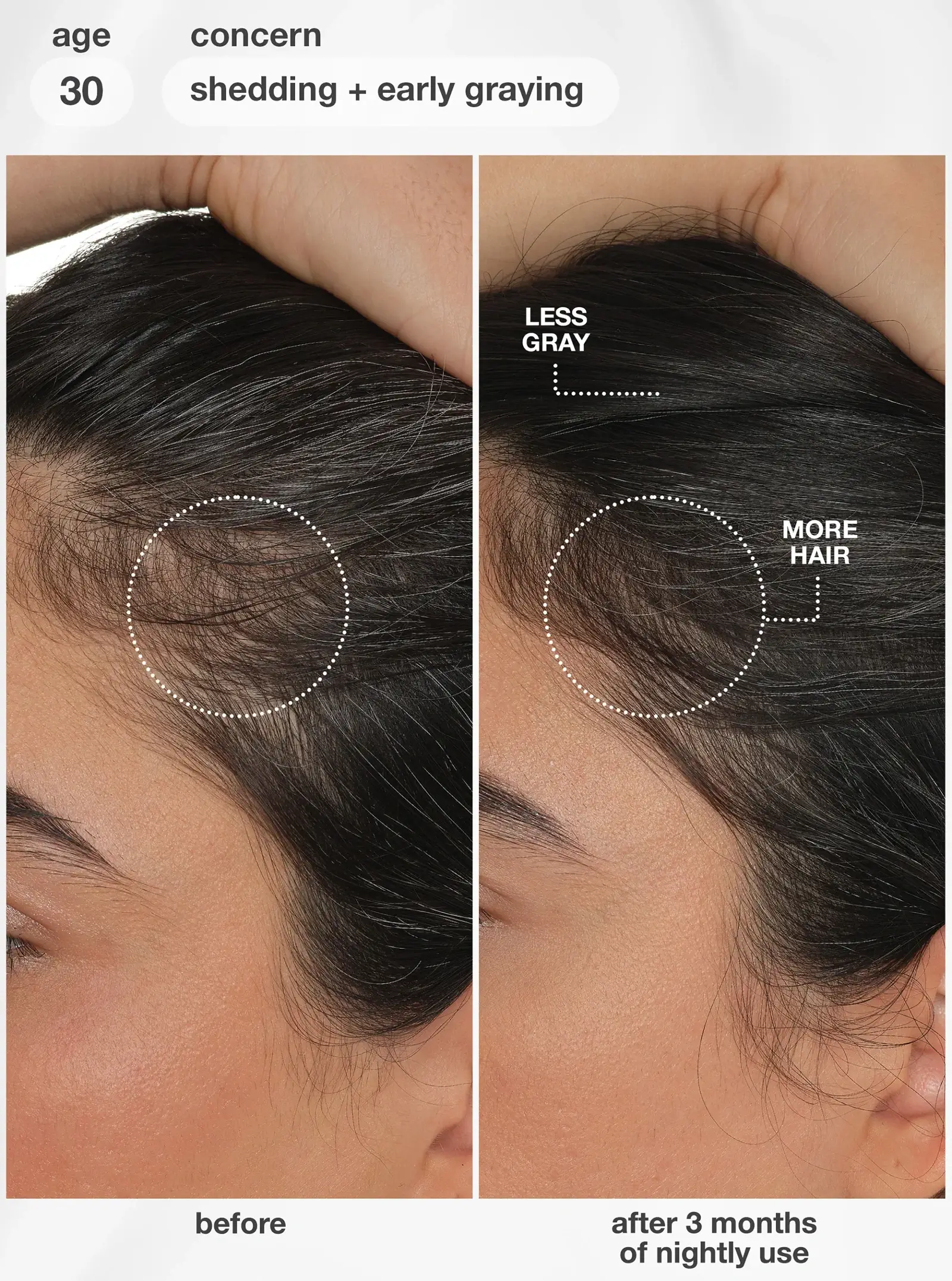 K18 FutureIQ Biomimetic Hair Longevity Serum 30 year old shedding and greying