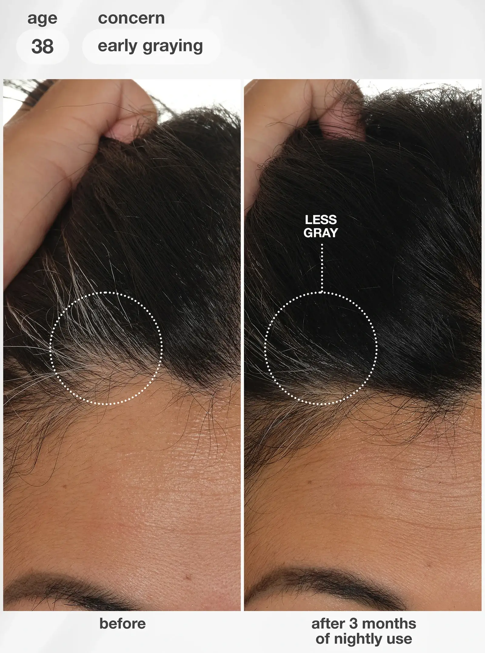 K18 FutureIQ Biomimetic Hair Longevity Serum 38 year old greying